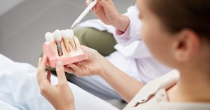 dental implants perth